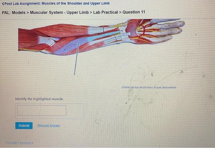 What is the origin of the highlighted muscle