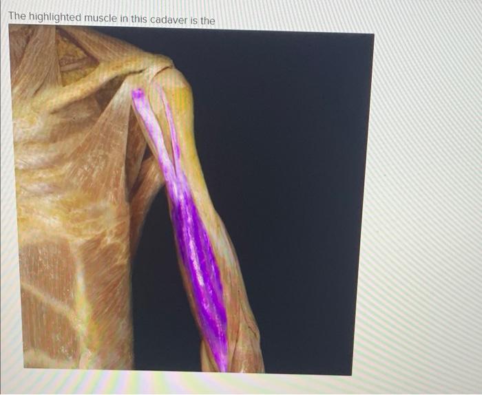 What is the origin of the highlighted muscle